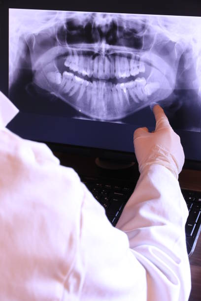 Best Tooth Pain Emergency Relief  in Murphys, CA
